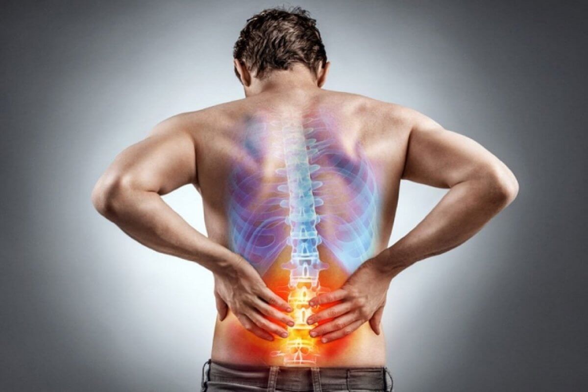 Man with Lower Back Pain in Newport Beach CA